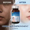 Glutathione + Collagen: The Golden Beauty Combination Behind Lumian